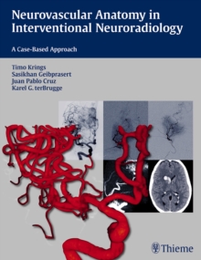 Image for Neurovascular Anatomy in Interventional Neuroradiology