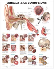 Image for Middle Ear Conditions Anatomical Chart