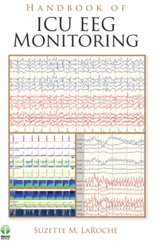Image for Handbook of ICU EEG monitoring