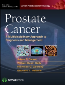 Image for Prostate cancer: a multidisciplinary approach to diagnosis and management