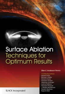 Image for Surface Ablation