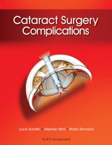 Image for Cataract Surgery Complications