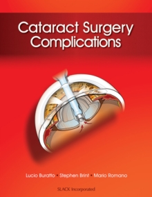 Cataract Surgery Complications