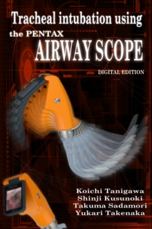 Image for Tracheal intubation using the PENTAX Airway Scope