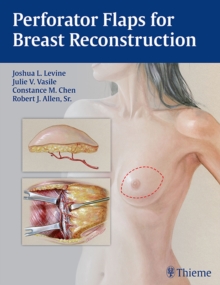 Image for Perforator Flaps for Breast Reconstruction