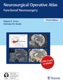 Image for Neurosurgical Operative Atlas : Functional Neurosurgery