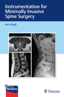 Image for Instrumentation for Minimally Invasive Spine Surgery