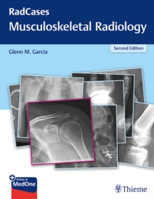 Image for RadCases Q&A Musculoskeletal Radiology