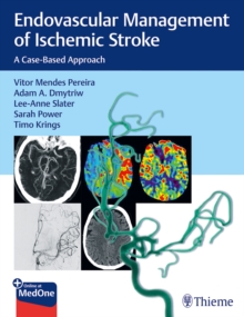 Image for Endovascular management of ischemic stroke  : case-based approach