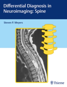 Image for Differential diagnosis in neuroimaging: Spine