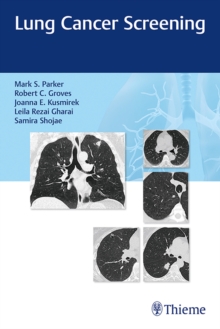 Image for Lung Cancer Screening