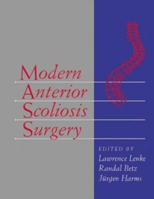 Image for Modern Anterior Scoliosis Surgery