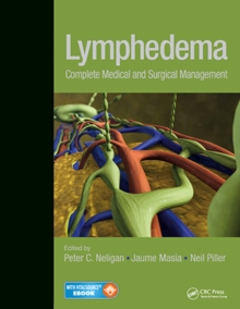 Image for Lymphedema : Complete Medical and Surgical Management