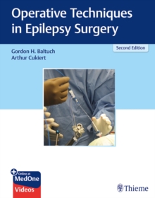 Image for Operative Techniques in Epilepsy Surgery