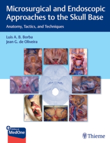Image for Microsurgical and Endoscopic Approaches to the Skull Base