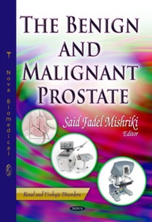 Image for Benign & Malignant Prostate