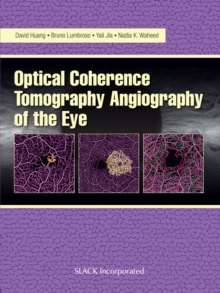 Image for Optical Coherence Tomography Angiography of the Eye : OCT Angiography