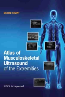 Image for Atlas of Musculoskeletal Ultrasound of the Extremities