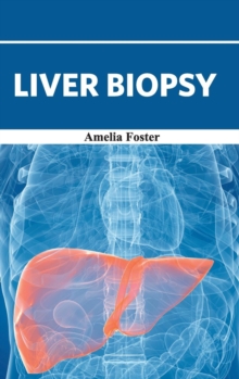 Image for Liver Biopsy