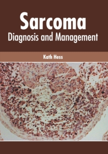 Image for Sarcoma: Diagnosis and Management