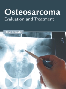Image for Osteosarcoma: Evaluation and Treatment