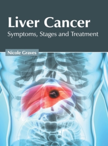 Image for Liver Cancer: Symptoms, Stages and Treatment