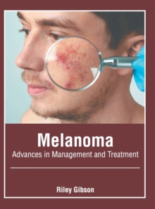 Image for Melanoma: Advances in Management and Treatment