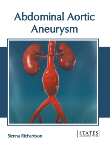 Image for Abdominal Aortic Aneurysm