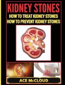 Image for Kidney Stones : How To Treat Kidney Stones: How To Prevent Kidney Stones