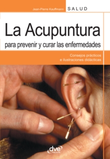 Image for La acupuntura para prevenir y curar las enfermedades