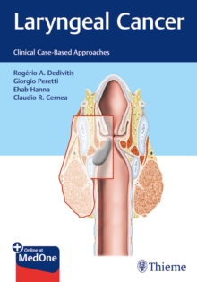 Image for Laryngeal Cancer