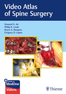 Image for Video Atlas of Spine Surgery
