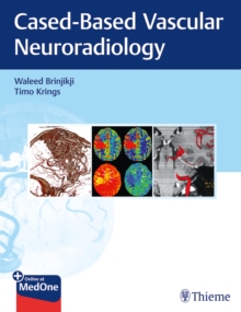 Image for Imaging in Neurovascular Disease : A Case-Based Approach