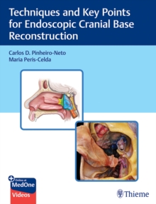 Image for Techniques and Key Points for Endoscopic Cranial Base Reconstruction