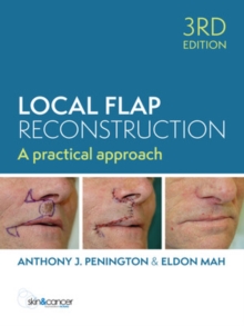 Local Flap Reconstruction