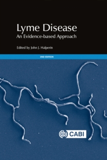Image for Lyme disease  : an evidence-based approach