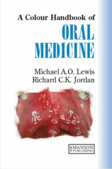 Image for Colour Handbook of Oral Medicine
