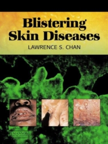 Image for Blistering skin diseases