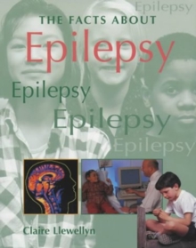 Image for The facts about epilepsy