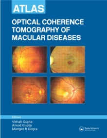 Image for Atlas of Optical Coherence Tomography of Macular Diseases