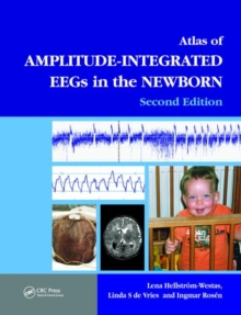 Atlas of Amplitude-Integrated EEGs in the Newborn