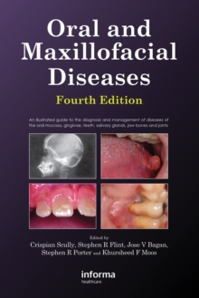 Image for Oral and maxillofacial diseases: an illustrated guide to diagnosis and management of diseases of the oral mucosa, gingivae, teeth, salivary glands, jaw bones and joints