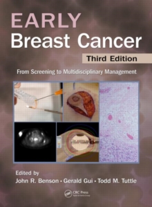 Image for Early breast cancer  : from screening to multidisciplinary management