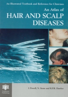Image for An Atlas of Hair and Scalp Diseases