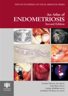 Image for An Atlas of Endometriosis