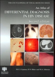 Atlas of HIV Disease