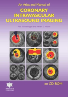 Image for An Atlas and Manual of Coronary Intravascular Ultrasound Imaging