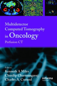 Image for Multi-Detector Computed Tomography in Oncology