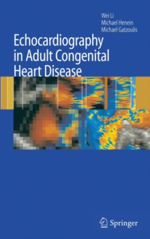 Image for Echocardiography in Adult Congenital Heart Disease