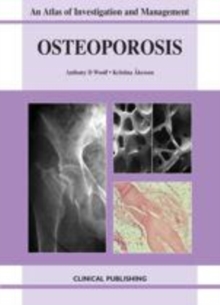 Image for Osteoporosis: an atlas of investigation and diagnosis